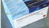 Roche In Situ Cell Death Detection Kit, POD试剂盒
